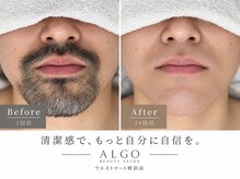 アルゴ 姪浜店(ALGO)の雰囲気（「青ヒゲ・カミソリ負けのお悩み」は大人気のヒゲ脱毛で解決♪）