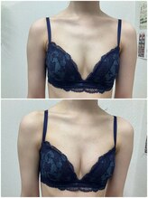 バーディー(BIRDIE)/施術１回/３０代