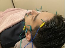 ポルクス鍼灸整骨院 表参道(Pollux鍼灸整骨院)/美容鍼灸