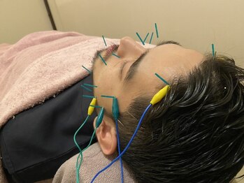 ポルクス鍼灸整骨院 表参道(Pollux鍼灸整骨院)/美容鍼灸