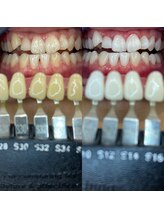 トウキョウスワーズ 池袋店(TOKYO SWRS)/#ホワイトニング #池袋 #渋谷