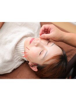 鍼灸施術を受けたい