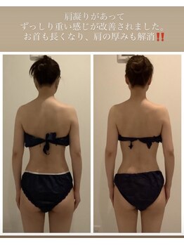 美容整骨小顔ラボ/ブライダル　ビフォーアフター