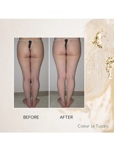 クーラ テュセ(Coeur la Tusais)/下半身集中痩身