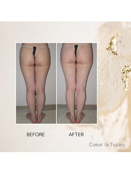 クーラ テュセ(Coeur la Tusais)/下半身集中痩身