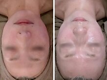 ディアナ 代々木上原(_Diana)/グリーンピール/Diana代々木上原