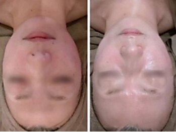 ディアナ 代々木上原(_Diana)/グリーンピール/Diana代々木上原