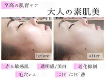 ラッシュビューティー(LASH Beauty)