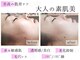 ラッシュビューティー(LASH Beauty)の写真
