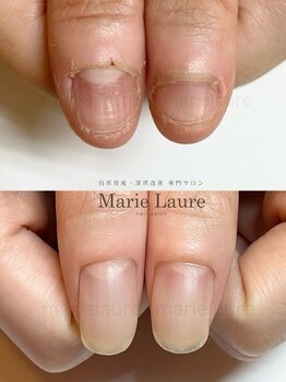 マリーロール 淀屋橋本店(Marie Laure)/深爪矯正/自爪育成/ネイルケア