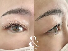 ムニ(muni)/&healthy【アンドヘルシー】