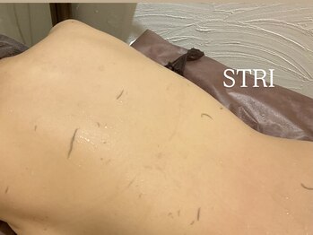 ストリ(STRI)/アカスリ