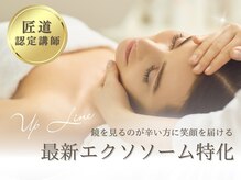 アップライン(Up Line)