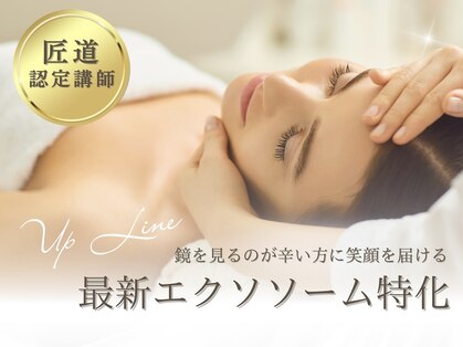 アップライン(Up Line)の写真