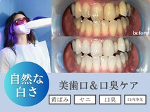 ミスティア(mistia)の雰囲気(第一印象は“歯の白さ”から♪気軽に通える歯のホワイトニング)