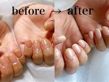 ティアム マタニティペイント アンド ネイル(Tiam Maternity Paint&Nail)/縦長美爪に導きます★