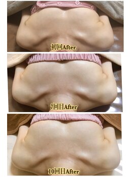 トータルボディセラピーハート(Heart)/どんどん育つ！！ バストアップ