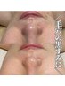 《ハーブピーリング》毛穴・黒ずみ・角質◎ツルツルコース　９０分
