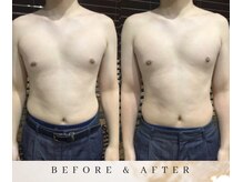 ゼロ アンド リセット(0ZERO&RESET)/【メンズ脱毛】0ZERO&RESET