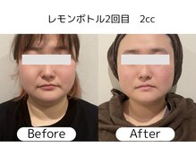 なごみ 菊池店の雰囲気（渡韓せずに熊本で体験！今話題の脂肪分解液『レモンボトル』）
