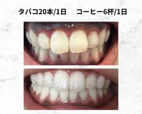 ホワイトニングビューティ 三川店