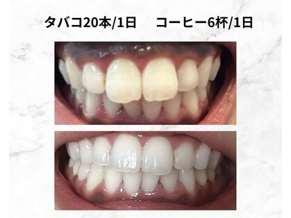 ホワイトニングビューティ 三川店の写真