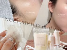 ノン(Non.)の雰囲気（大人気！産毛をごそっと！話題のフェイシャルワックスも◎）