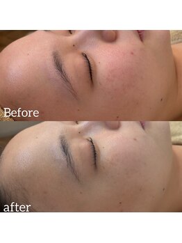 ウィルビューティーサロン(will beauty salon)/クリスティーナ　アンストレス