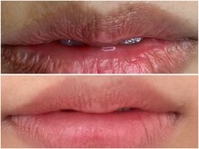 ピンクアンドプラウドサロン 横浜(Pink& Proud Salon)/ローマピンク【唇】