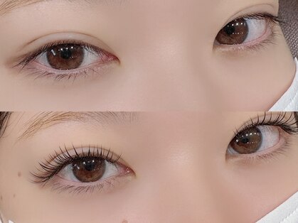 ジューシーアイ 成増店(Juicy Eye)の写真