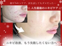 エピア 岡崎店(Epia)