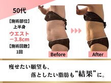 クレビア(Clevia)