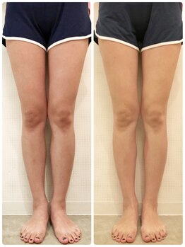 トリプルサンショップ 京都店/【ボディメイク＋MIKI'sプロ】