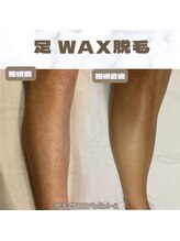 ビビユー(bibi u)/足WAX脱毛ビフォーアフター　