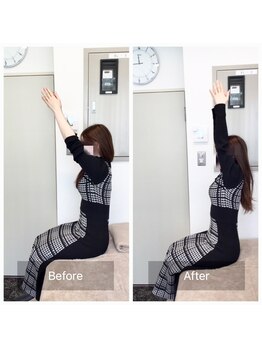 ナオル整体 新宿院(NAORU整体)/20代女性-猫背矯正Before/After