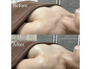 ブレスト サロン 奈良店(Bryst Salon)/バストアップ症例