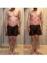 アリッチ 岡崎店(a.Rich)/まき肩改善バストアップ！！