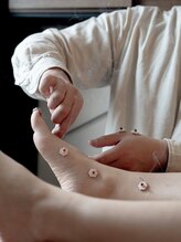 ひとはり/優しく細い鍼と柔らかいお灸