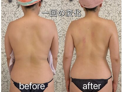 マテリアル 痩身骨気サロン(MATERIAL)の写真