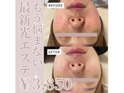 サロンモア(salon More)の写真