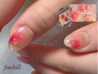 フレチル(frachill)の写真