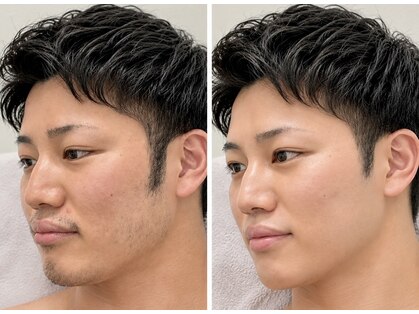ピュアボディ(Pure Body)の写真