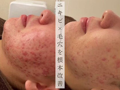 ミレア 恵比寿(MIREA)の写真