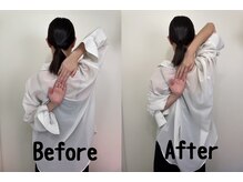 コガオファクトリー 北24条店(KOGAO FACTORY)/巻き肩徹底改善！