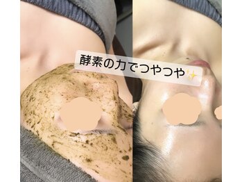 ディライト 名古屋駅店(Delight)/ハーブピーリング＋生酵素