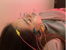 ポルクス鍼灸整骨院 表参道(Pollux鍼灸整骨院)/美容鍼灸