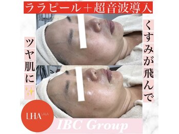 IBC 上大岡店/ツヤ肌に！ララピール