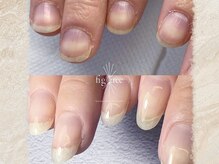 フィグ ツリー(fig tree)の雰囲気（本気で地爪育成してます!!変わりたい方お待ちしております!!）