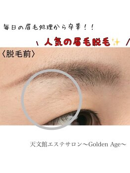 ゴールデンエイジ(Golden Age)/眉毛脱毛【毛穴/小顔/ニキビ】