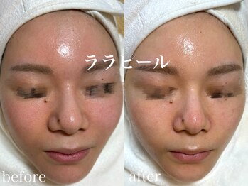 ネオリー(neorii)/ララピール　韓国艶肌